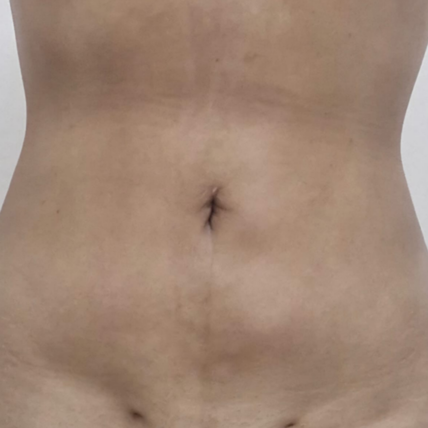 Terapia Pre/Post Operatoria