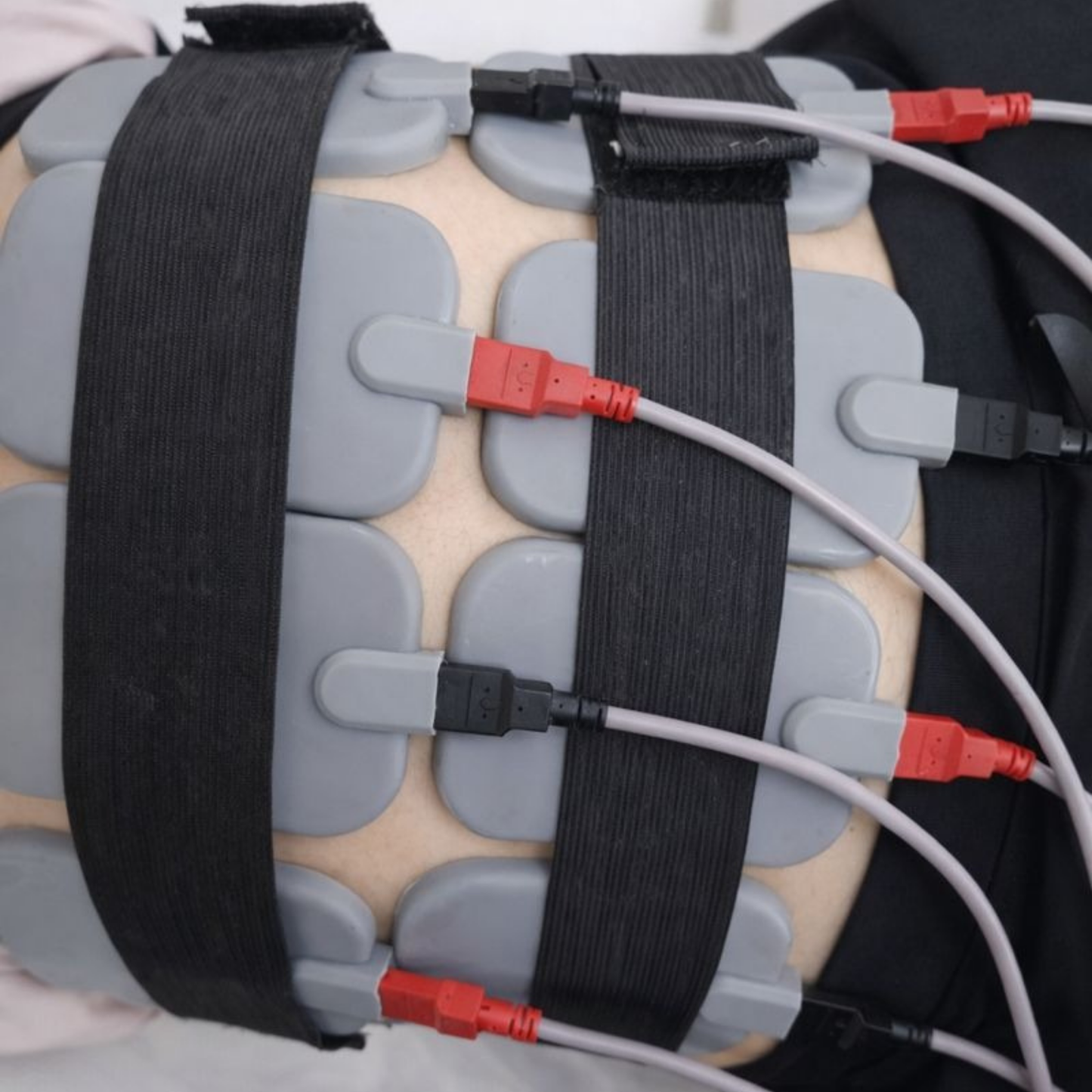 Tratamiento Reductivo Levantamiento de Glúteos